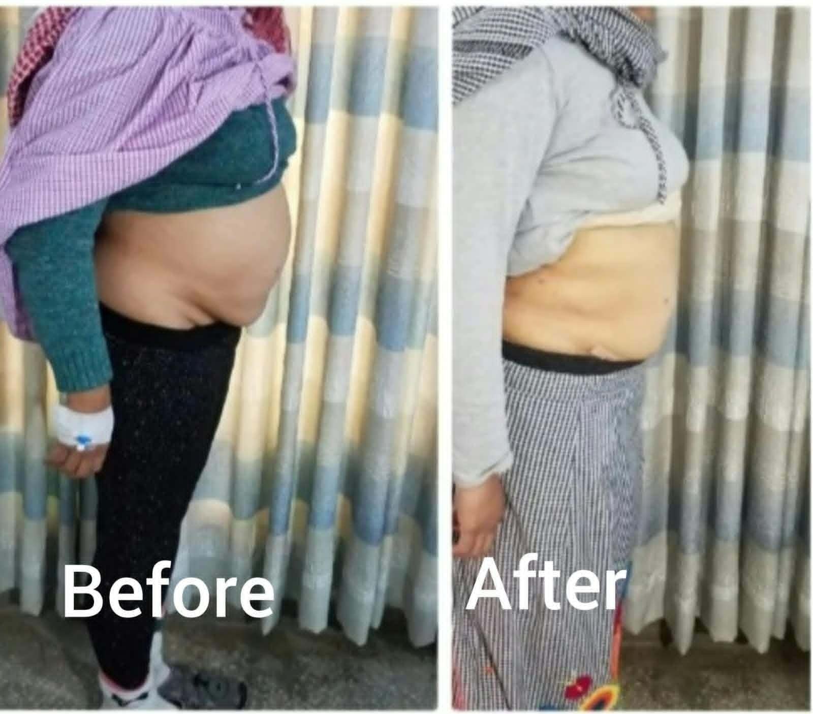 Transformation result 5